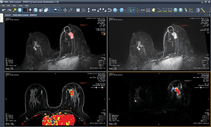 Image: The Aegis breast imaging workstation (Photo courtesy of Sentinelle Medical). Image: The Aegis breast imaging workstation (Photo courtesy of Sentinelle Medical).